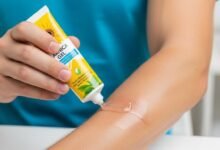 دليل شامل حول دواعي استعمال Arnica Gel